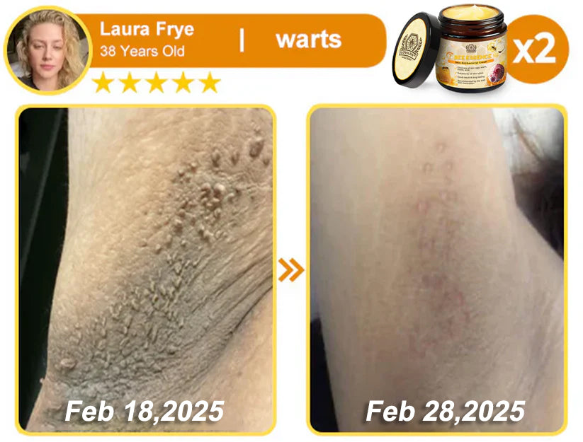 Dermavell™ Bee Essence Skin Antibacterial Cream—used to treat a variety of skin diseases (AAD recommended)