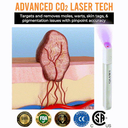 ✨Glossy™ All-in-One CO₂ Laser Eraser Pen | Removes Moles, Warts, Skin Flaws & Pigmentation