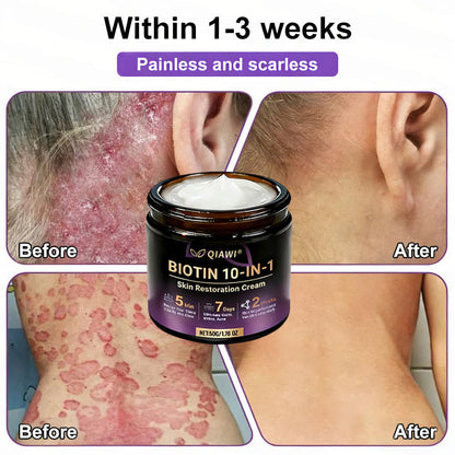𝐎𝐟𝐟𝐢𝐜𝐢𝐚𝐥 𝐒𝐭𝐨𝐫𝐞 |  🏅 Made and Shipped from USA ✨QIAWI® Biotin 10-in-1 Skin Restoration Cream 🍀