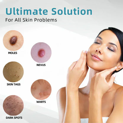 ✨Glossy™ All-in-One CO₂ Laser Eraser Pen | Removes Moles, Warts, Skin Flaws & Pigmentation