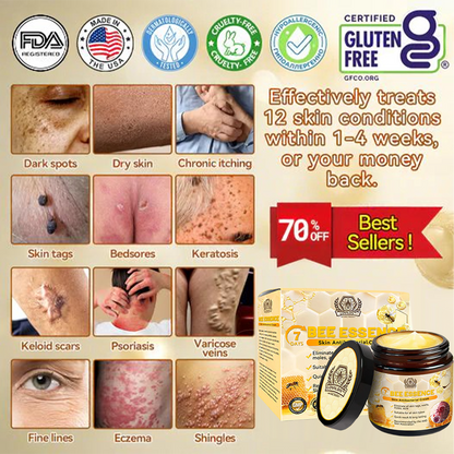 Dermavell™ Bee Essence Skin Antibacterial Cream—used to treat a variety of skin diseases (AAD recommended)