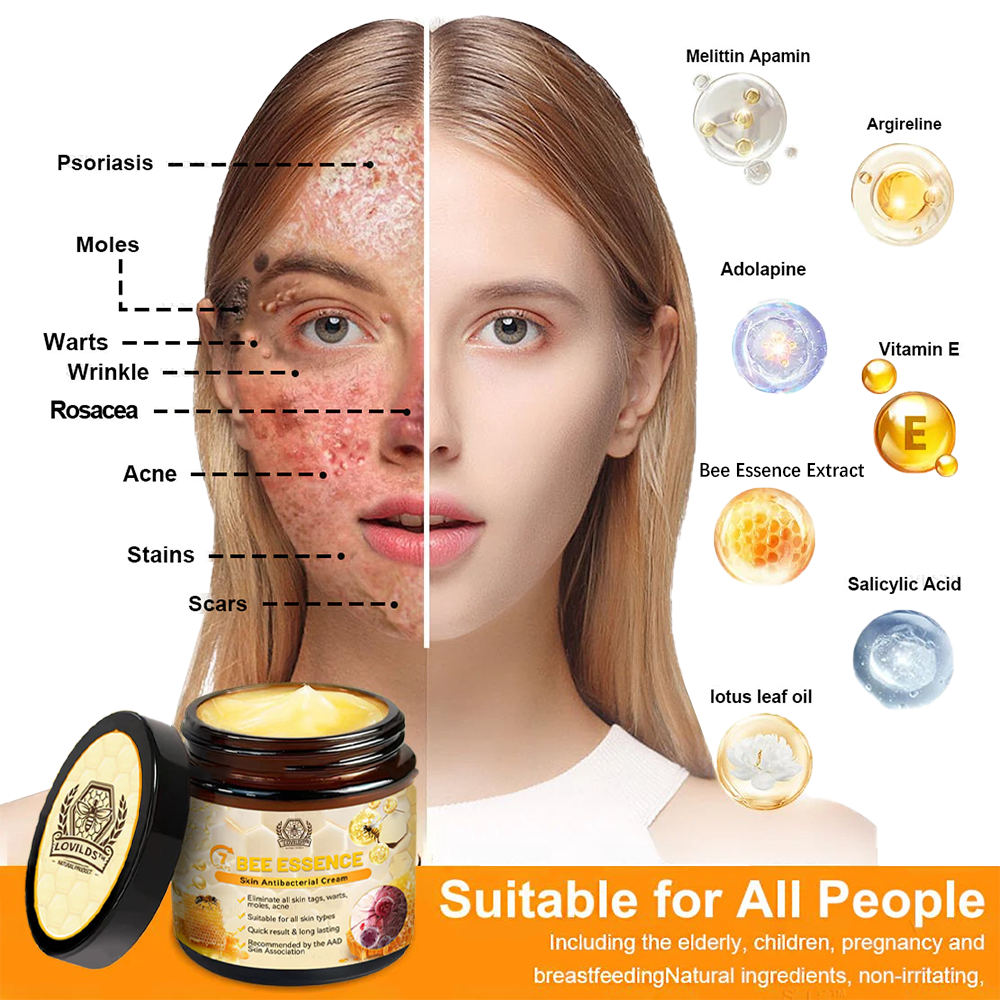 Dermavell™ Bee Essence Skin Antibacterial Cream—used to treat a variety of skin diseases (AAD recommended)