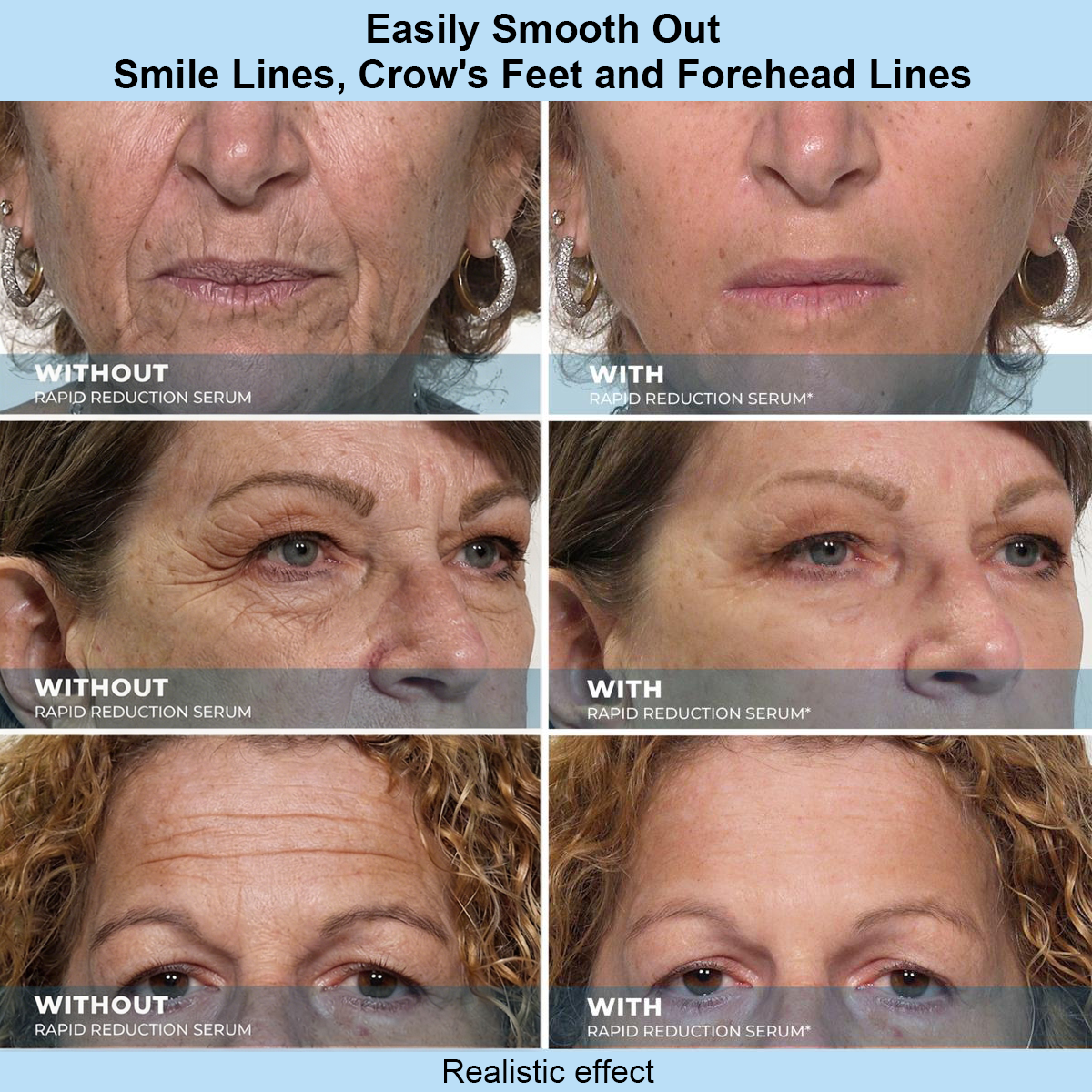 ZORTRIO™ Instant Face Temporary Tightener – Instant visible results in 30 seconds