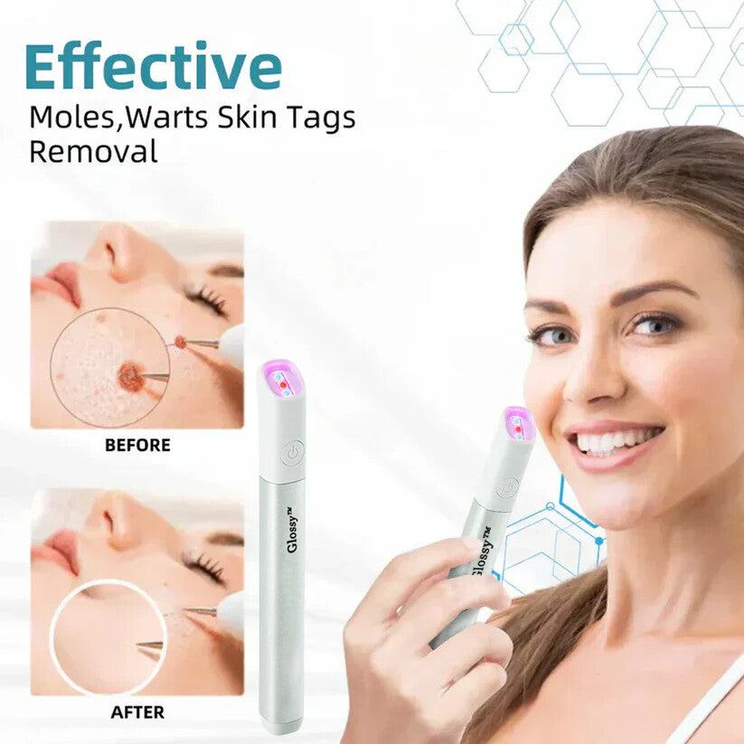 ✨Glossy™ All-in-One CO₂ Laser Eraser Pen | Removes Moles, Warts, Skin Flaws & Pigmentation