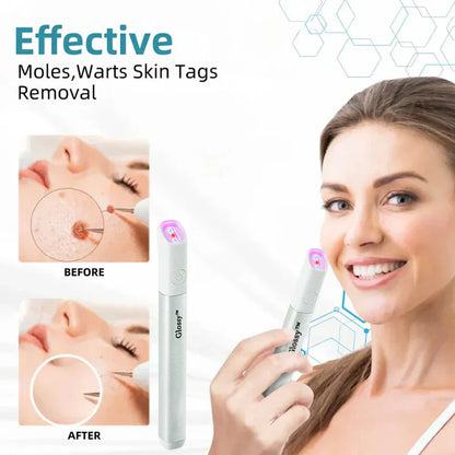 ✨Glossy™ All-in-One CO₂ Laser Eraser Pen | Removes Moles, Warts, Skin Flaws & Pigmentation