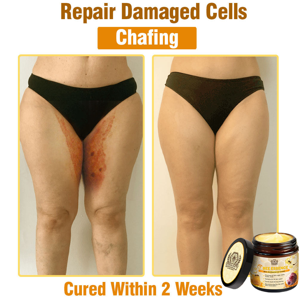 Dermavell™ Bee Essence Skin Antibacterial Cream—used to treat a variety of skin diseases (AAD recommended)