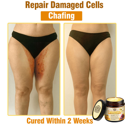 Dermavell™ Bee Essence Skin Antibacterial Cream—used to treat a variety of skin diseases (AAD recommended)