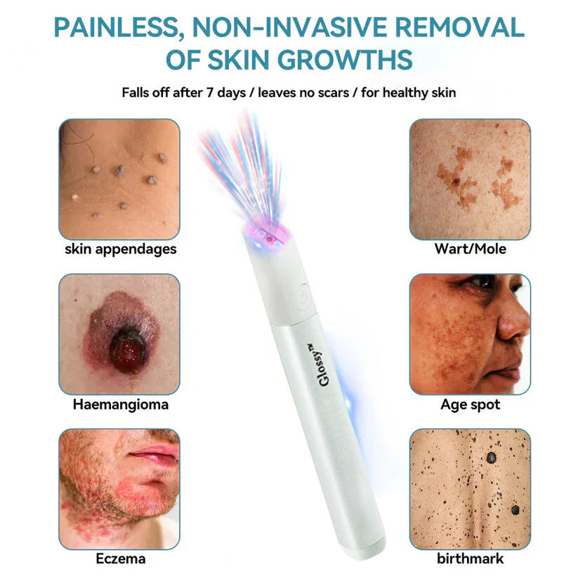 ✨Glossy™ All-in-One CO₂ Laser Eraser Pen | Removes Moles, Warts, Skin Flaws & Pigmentation