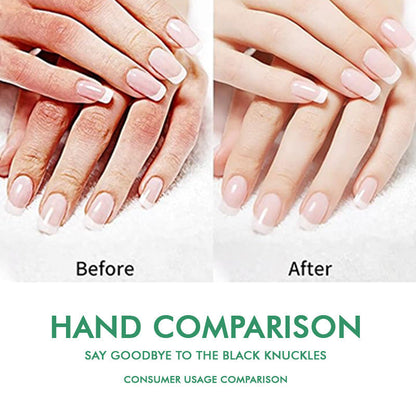42% Urea Moisturizing Exfoliating Cream