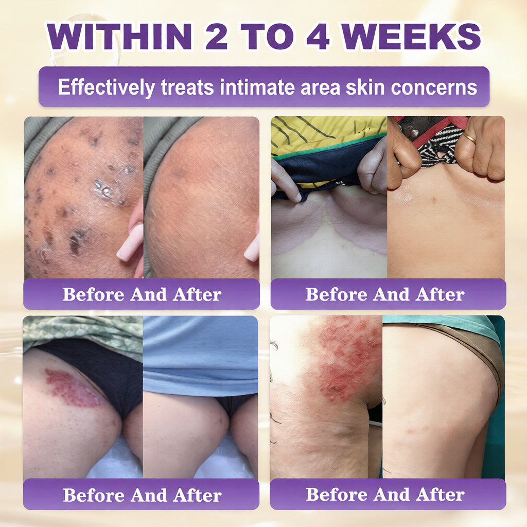 𝐎𝐟𝐟𝐢𝐜𝐢𝐚𝐥 𝐒𝐭𝐨𝐫𝐞 |  🏅 Made and Shipped from USA ✨QIAWI® Biotin 10-in-1 Skin Restoration Cream 🍀