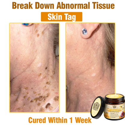 Dermavell™ Bee Essence Skin Antibacterial Cream—used to treat a variety of skin diseases (AAD recommended)