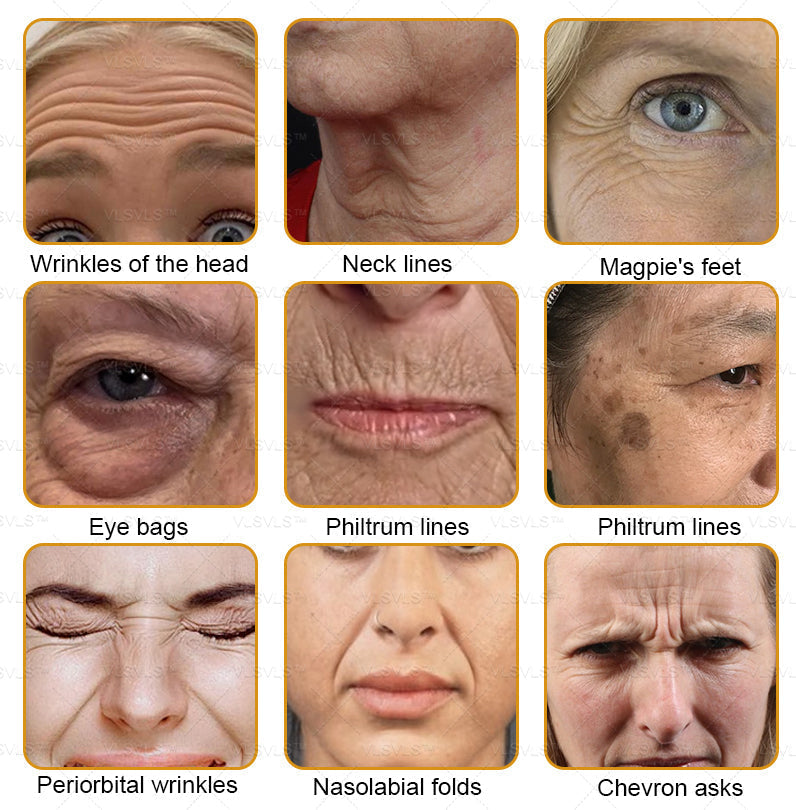 Dermavell™ Bee Essence Skin Antibacterial Cream—used to treat a variety of skin diseases (AAD recommended)