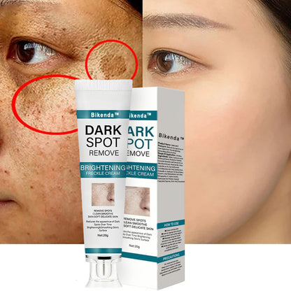 [Official Store] Bikenda™ Blemish Removing Beauty Cream – Fades Dark Spots, Freckles & Wrinkles | Age-Defying, Even-Tone Treatment