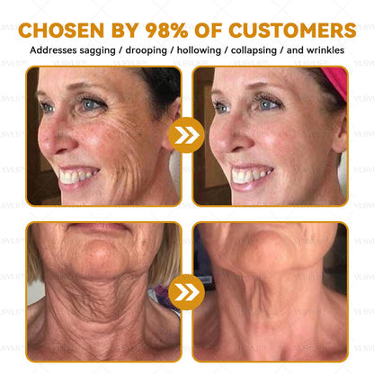 Dermavell™ Bee Essence Skin Antibacterial Cream—used to treat a variety of skin diseases (AAD recommended)