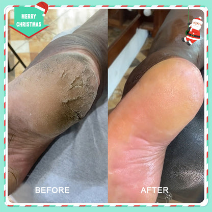 42% Urea Moisturizing Exfoliating Cream