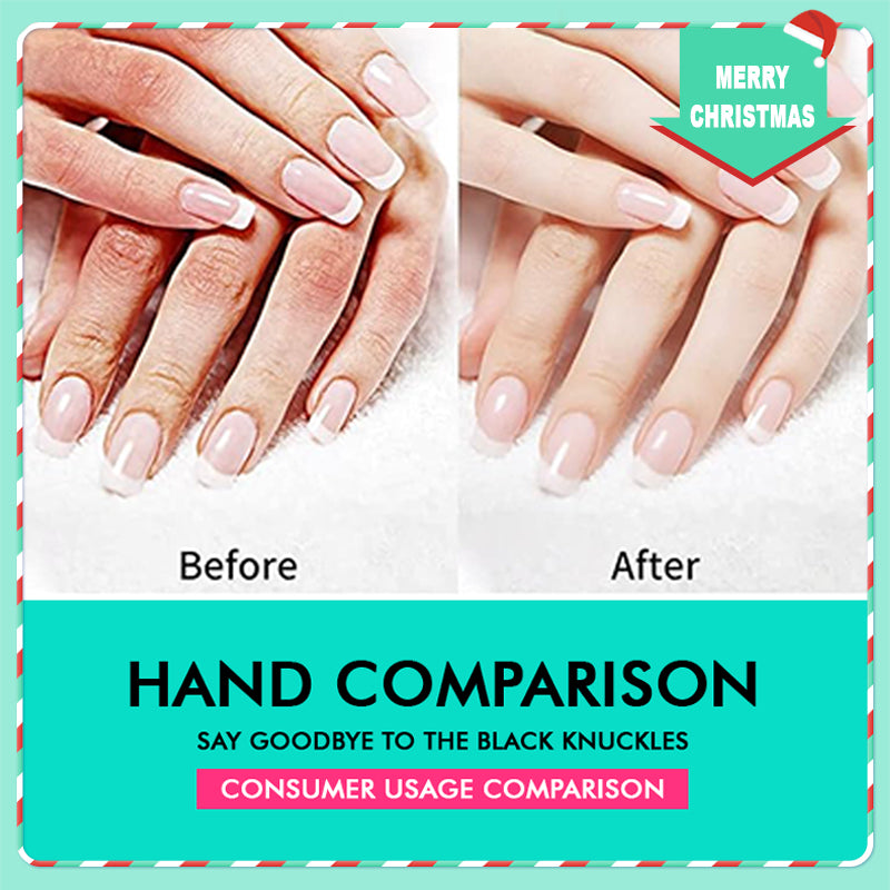 42% Urea Moisturizing Exfoliating Cream
