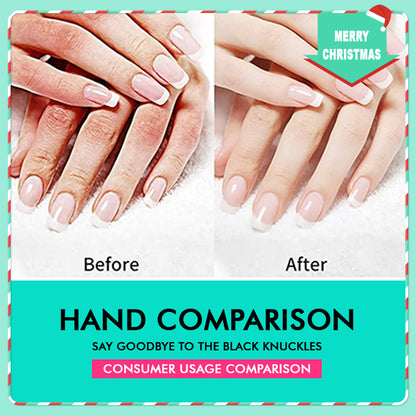 42% Urea Moisturizing Exfoliating Cream