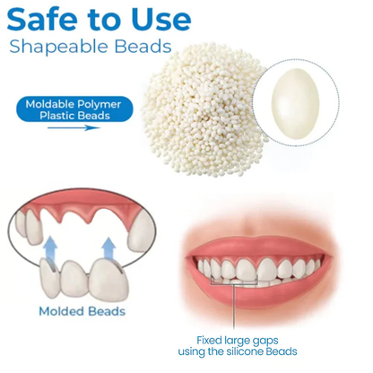 Glossy™ Glory Smile Temporary Tooth Sculptor Repair Kit