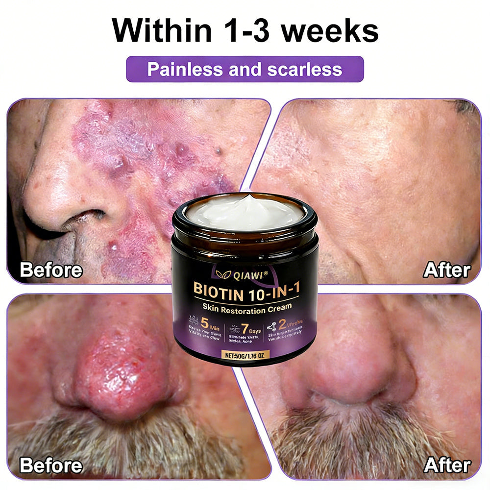 𝐎𝐟𝐟𝐢𝐜𝐢𝐚𝐥 𝐒𝐭𝐨𝐫𝐞 |  🏅 Made and Shipped from USA ✨QIAWI® Biotin 10-in-1 Skin Restoration Cream 🍀