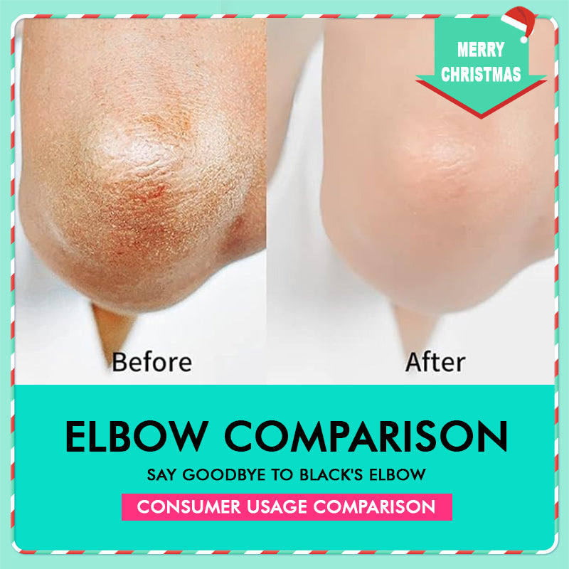 42% Urea Moisturizing Exfoliating Cream