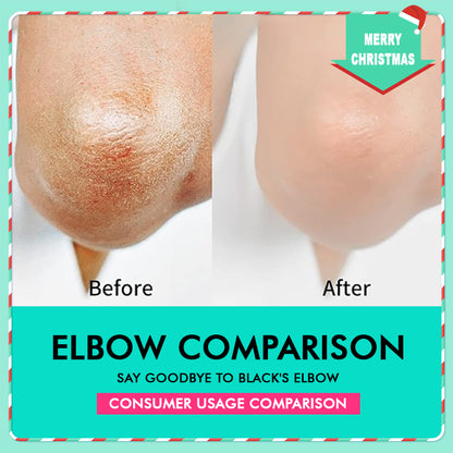 42% Urea Moisturizing Exfoliating Cream