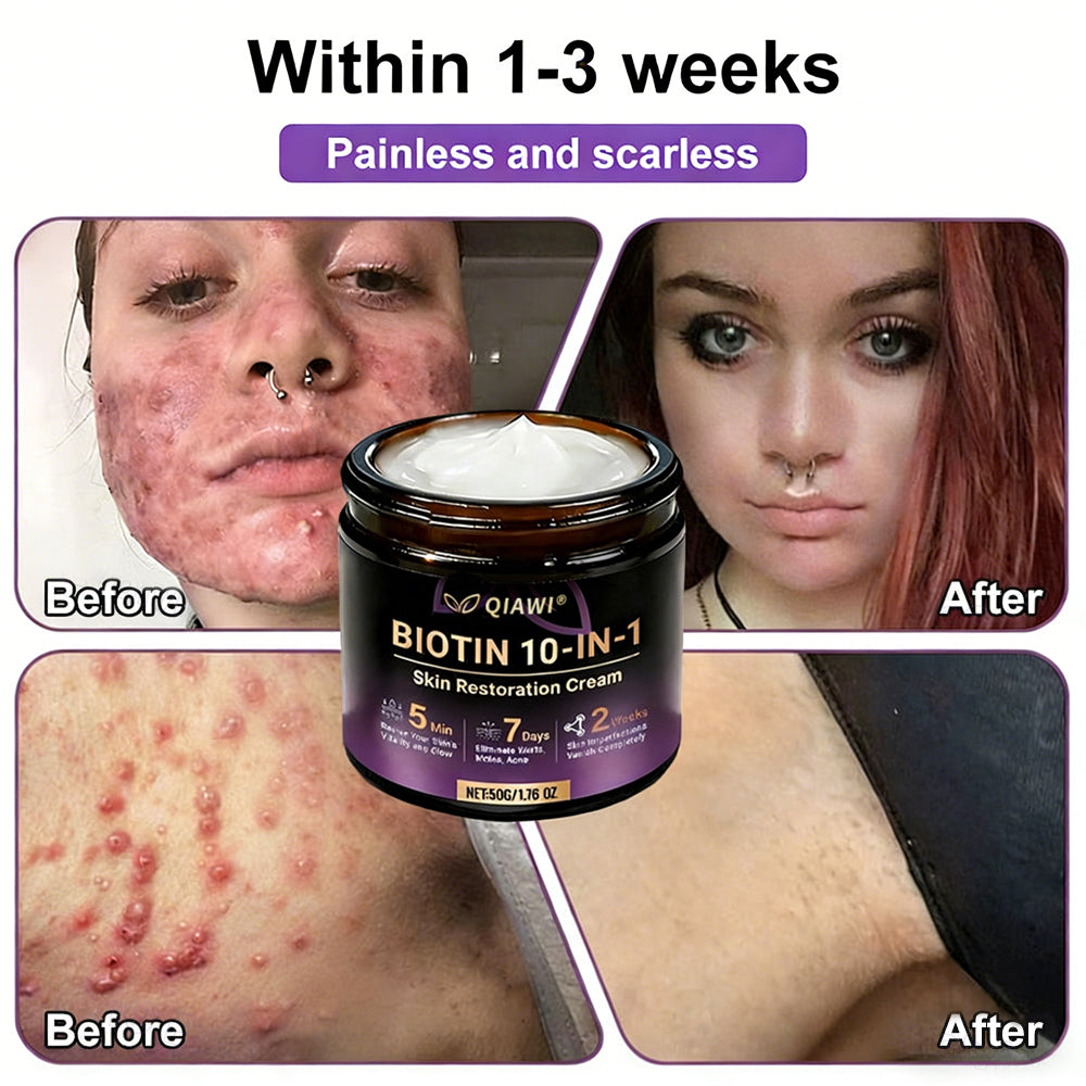 𝐎𝐟𝐟𝐢𝐜𝐢𝐚𝐥 𝐒𝐭𝐨𝐫𝐞 |  🏅 Made and Shipped from USA ✨QIAWI® Biotin 10-in-1 Skin Restoration Cream 🍀