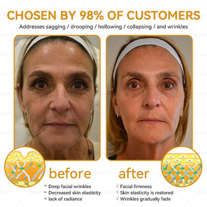 Dermavell™ Bee Essence Skin Antibacterial Cream—used to treat a variety of skin diseases (AAD recommended)