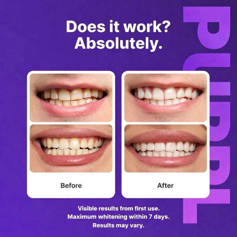 PURPL Color Correcting Whitening Strips 14ct