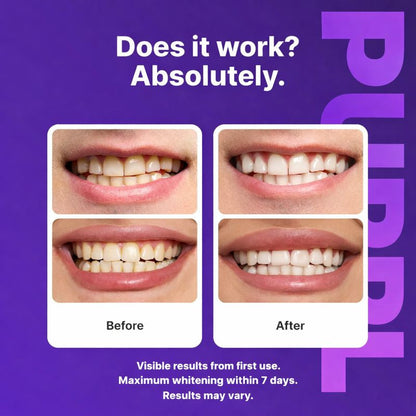 PURPL Color Correcting Whitening Strips 14ct
