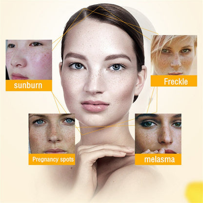 [Official Store] Bikenda™ Blemish Removing Beauty Cream – Fades Dark Spots, Freckles & Wrinkles | Age-Defying, Even-Tone Treatment