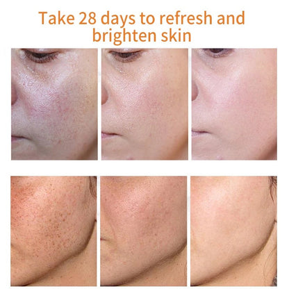 [Official Store] Bikenda™ Blemish Removing Beauty Cream – Fades Dark Spots, Freckles & Wrinkles | Age-Defying, Even-Tone Treatment