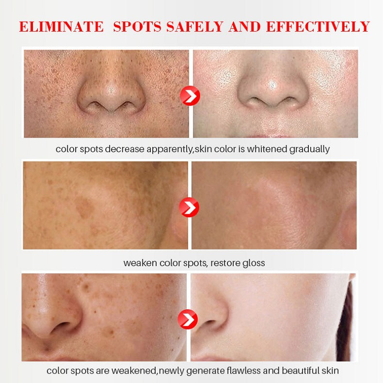 [Official Store] Bikenda™ Blemish Removing Beauty Cream – Fades Dark Spots, Freckles & Wrinkles | Age-Defying, Even-Tone Treatment