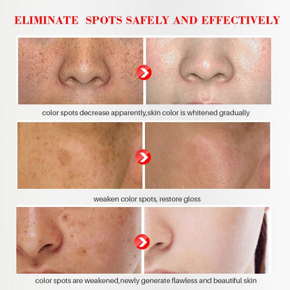 [Official Store] Bikenda™ Blemish Removing Beauty Cream – Fades Dark Spots, Freckles & Wrinkles | Age-Defying, Even-Tone Treatment