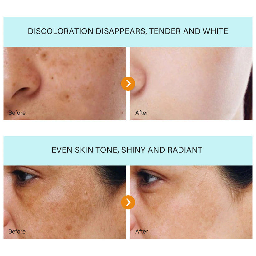 [Official Store] Bikenda™ Blemish Removing Beauty Cream – Fades Dark Spots, Freckles & Wrinkles | Age-Defying, Even-Tone Treatment