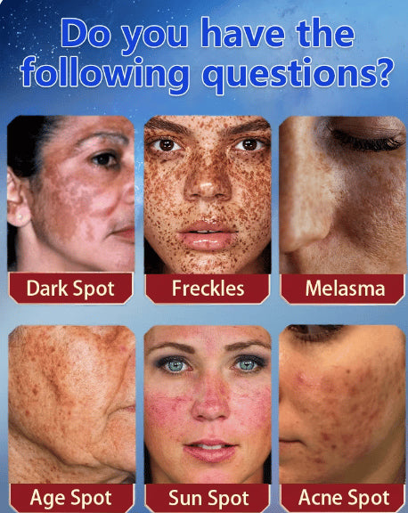 [Official Store] Bikenda™ Blemish Removing Beauty Cream – Fades Dark Spots, Freckles & Wrinkles | Age-Defying, Even-Tone Treatment